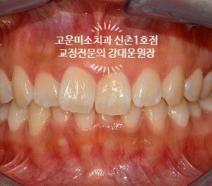 화면 캡처 2025-11-10 142453